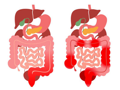 Pancreas Healthy Foods