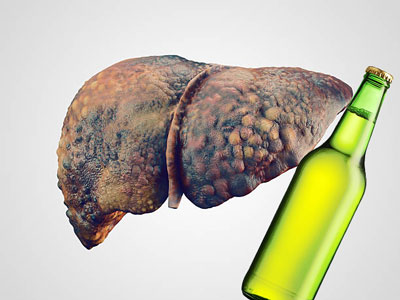Famous Gastroenterologist in Hyderabad