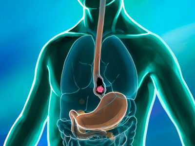 Best doctor for colonoscopy in Hyderabads