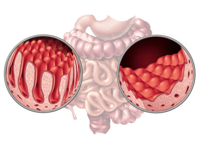 Food for Pancreas