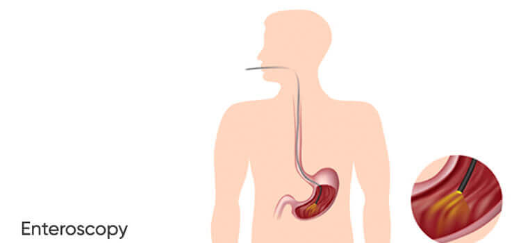 Gastroenterology Doctor in Hyderabad