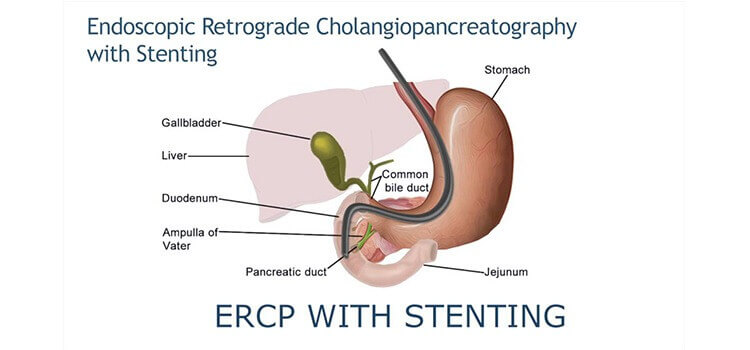 Top Gastroenterologist in Hyderabad