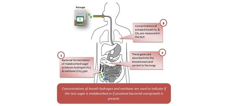 ERCP Treatment in Hyderabad