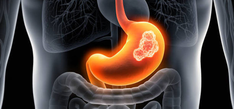 Best Gastroenterologist in Hyderabad India