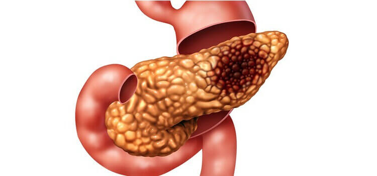 Best Gastroenterologist in Madhapur